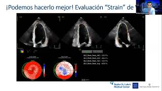 Webinar FAC Estenosis aórtica moderada y severa asintomática ¿son todas iguales [upl. by Sudderth]