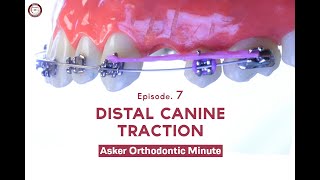 Distal Canine Traction Asker Orthodontic Minute Episode 7 [upl. by Danella]