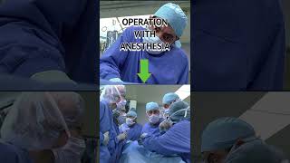 OPERATION WITH AND WITHOUT ANESTHESIA  Mr Bean Videos [upl. by Garling]