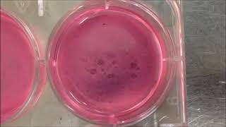 Modelling ischemiareperfusion injury IRI in vitro using metabolically matured induced pluripotent [upl. by Silloh]