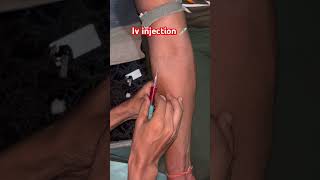 Iv injection viralvideo li [upl. by Rehpotsirhc]