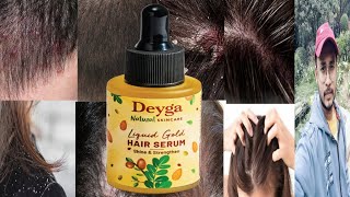 Deyga Liquid Gold Hair Serum  Honest Review [upl. by Laerol]