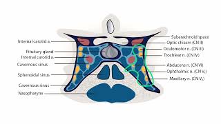 Cerebral Venous Thrombosis  Neurology section 2 Magnetic Resonance Venography [upl. by Kohn]