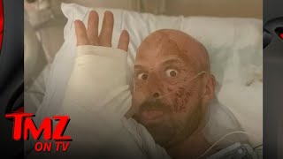 AGT Extreme Contestant Jonathan Goodwin Breaks Silence On Horrific Accident  TMZ TV [upl. by Ikcaj]