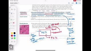 causes of goiter endocrinology 47  First Aid USMLE Step 1 in UrduHindi [upl. by Danzig]