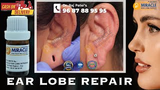 Earlobe  Hole Repair By Ear Pasting lotion  Ear Repair Torn Ear lobe Repaired Earlobe 9687889595 [upl. by Garges]