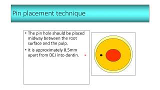 Treatment Of Mutilated Teeth Restoration Of Badly Broken Down Teeth Part 2 [upl. by Eicnarf318]