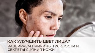 Как улучшить цвет лица Разбираем причины тусклости и секреты сияния кожи [upl. by Jarred]