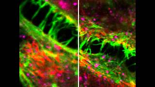 ZEISS LSM 880 HeLa cells with Airyscan [upl. by Anitnelav]