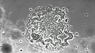 Megakaryocyte and platelet formation [upl. by Ysac208]