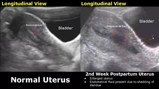 Gynecological amp Obstetric Ultrasound Normal Vs Abnormal Scan  Uterus Ovary Cervix Pregnancy USG [upl. by Ecyak]