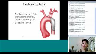 Quiz on Coarctation RX by Dr Sunita Maheshwari [upl. by Nohpets]