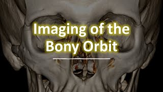 Imaging of the bony orbit [upl. by Duomham838]