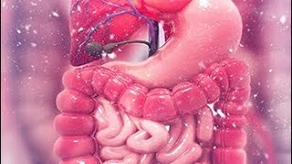 Intestinal obstruction part 2 and Benign tumor of intestine [upl. by Aneladdam]