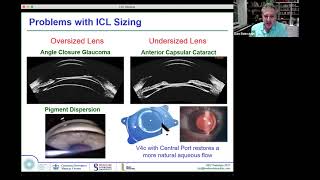 ASCRS Dan Reinstein Arcscan Insight 100 Applications  Raising the Standard Cornea and ICL [upl. by Inirt755]