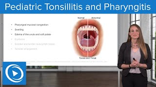 Pediatric Tonsillitis and Pharyngitis – Pediatric Nursing  Lecturio [upl. by Hazlip]