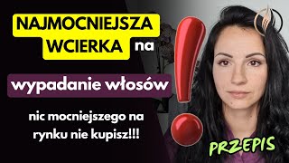 Przepis na najmocniejszą wcierkę na wypadanie włosów  Dlaczego domowa wcierka jest najlepsza [upl. by Randee]