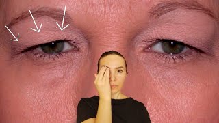 Fix droopy eyelids  How to tighten droopy eyelids [upl. by Yensehc157]