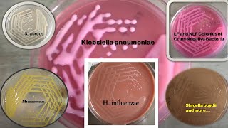 Colony characteristics of Staphylococcus Enterococcus E coli Klebsiella MicrococcusSalmonella [upl. by Tonie]