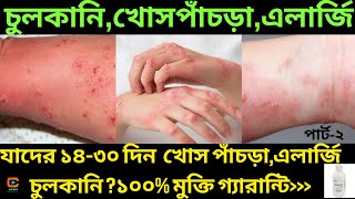 খোস পাঁচড়া ঔষধ।Scabies Treatment bangla😫 স্ক্যাবিস চিকিৎসা।Scabis।খোস পাঁচড়া।চর্মরোগ​ চিকিৎসা [upl. by Stoll]