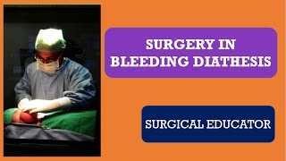 SURGERY IN BLEEDING DIATHESIS [upl. by Ennoval]