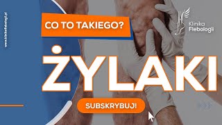 Żylaki  co to takiego [upl. by Greenlee]