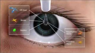 Alcon Dry Eye Video and Systane Ultra Action [upl. by Nyrehtak]