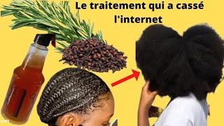 UTILISEZ LES CLOUS DE GIROFLE POUR LA POUSSE NATURELLE DES CHEVEUX [upl. by Petua669]