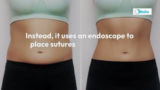 Looking for a NonSurgical Weight Loss Solution Try Endoscopic Sleeve Gastroplasty in dallastx [upl. by Nets]