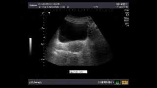 PELVIC ULTRASOUND PROTOCOLwmv [upl. by Rheims953]