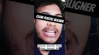 Removal Retainer DentalHealthTips [upl. by Ecinnaj]