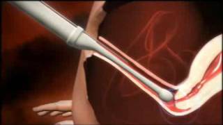 3D animation of how IVF works [upl. by Htebazil]