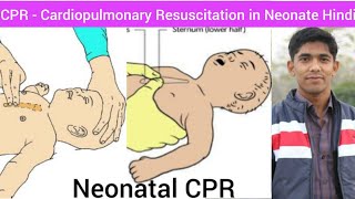 Neonatal CPR  Cardiopulmonary Resuscitation  in Hindi  How to Give CPR in Neonatal  CPR Hindi [upl. by Boelter]