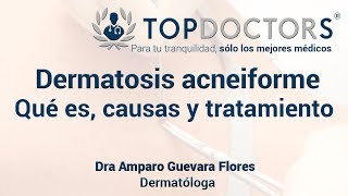 Dermatosis acneiforme Qué es causas y tratamiento [upl. by Pyne180]