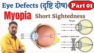 Eye Defects दृष्टि दोष Part 01MyopiaShort Sightednessनिकट दृष्टि दोषBy Summit Sir [upl. by Ardiekal770]