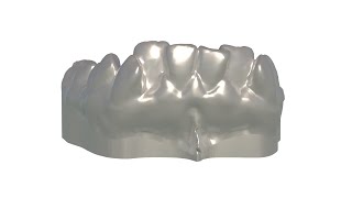 How to add a smooth base to a Dental model [upl. by Nwadrebma]