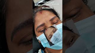 Microblading trendingshort banglore youtubeshorts vairalshort viralvideo youtubevideoytviral [upl. by Adnamar188]