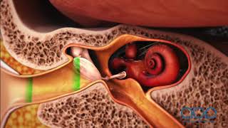 How the Ear Works  3D Medical Animation  ABP © [upl. by Neila452]