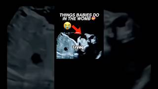 Things babies do in the womb ultrasound pregnancy baby cutebaby womenshealth [upl. by Donny354]