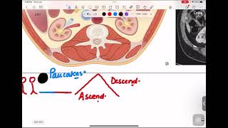 GITRetroperitoneal Organs [upl. by Suissac28]