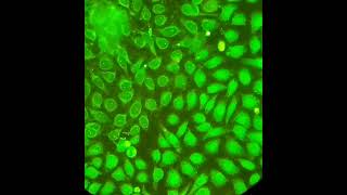 immunofluorescence test Autoantibodies against few nuclear dots performed by EUROIMMUN kit [upl. by Yecart]