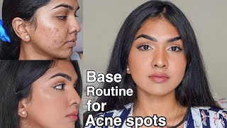 Flawless base routine for acne prone skin  acne pigmentation [upl. by Einnahpets]