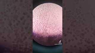 How to do urinalysis laboratory medtechstudent medtech microscope urinalysis urine [upl. by Hairom]