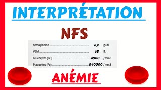 Numération formule sanguine  ANÉMIE  Interprétation [upl. by Eudora]