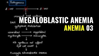 Megaloblastic Anemia  Schilling Test  Anemia 03  Pathology MBBS IOM [upl. by Raual]