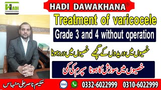 What to do After Varicocele Surgery  Varicocele kya hai  Varicocele ka ilaj in Urdu  Hindi [upl. by Iggam58]