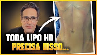 MOSTRANDO OS DETALHES DA LIPO HD DAS MINHAS PACIENTES [upl. by Lissner]