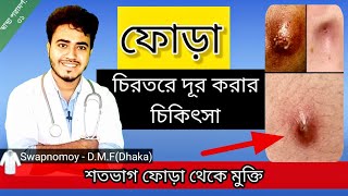 ফোড়া হলে করনিয় এবং ফোড়ার সঠিক চিকিৎসা  Abscess  Boil  Swapnomoy  Health advice31 [upl. by Mulvihill]