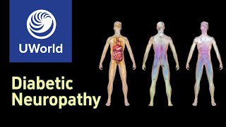 Diabetic Neuropathy  Pathophysiology Signs Symptoms  USMLE UWorld Step 1 Question MBBS MEDSTUDY [upl. by Layor183]