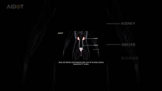 URO dot AI AI based urinary stone detection system [upl. by Appilihp342]